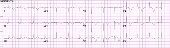 EKG12-1024x292