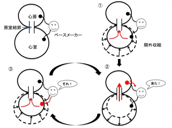 PMT-pathophys