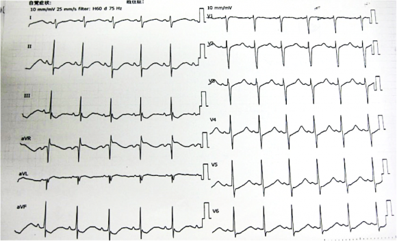 ecg1307a3