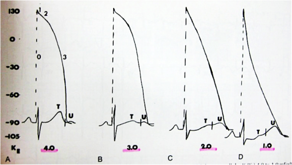 ecg1307a7