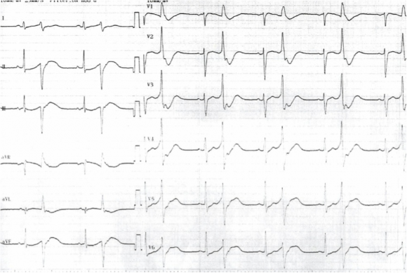 ecg1307a8